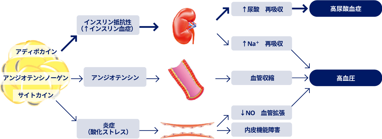 肥満症 | 脂質異常症、高血圧、高尿酸血症・痛風 | 肥満に関連する健康障害 | 医療従事者向けサイト | ノボ ノルディスク プロ